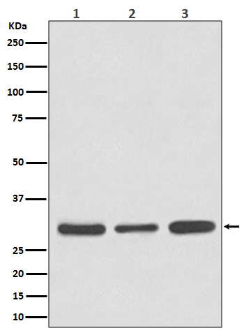 WB - Anti-Caspase 3 Rabbit Monoclonal Antibody ABO16560
